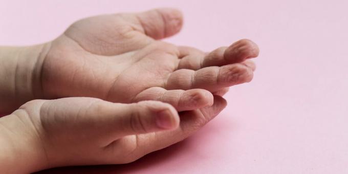 Réactions corporelles: plissement de la peau sur les doigts