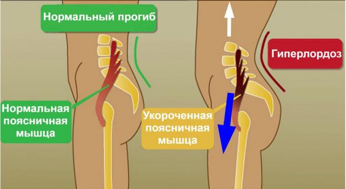 avant scission: psoas