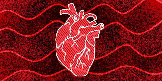 11 signes que vous pouvez arriver un arrêt cardiaque