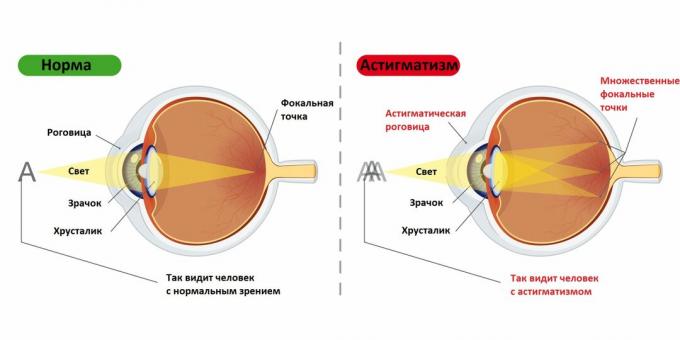 Vision d'une personne avec et sans astigmatis