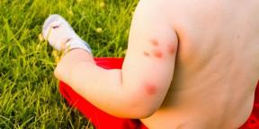 Que faire si vous êtes allergique aux piqûres de moustiques et de moucherons