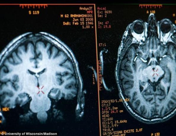 l'image du cerveau Mathieu Ricard obtenu par IRM