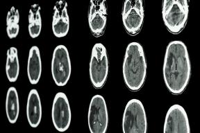 3 confirmation scientifique des caractéristiques étonnantes de notre cerveau