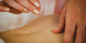 Acupuncture: Que faut savoir sur les fines aiguilles de traitement